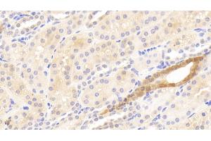 Detection of MMP13 in Human Kidney Tissue using Polyclonal Antibody to Matrix Metalloproteinase 13 (MMP13) (MMP13 Antikörper  (AA 290-468))