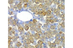 Immunohistochemistry of paraffin-embedded Mouse liver using FAH Polyclonal Antibody at dilution of 1:100 (40x lens). (FAH Antikörper)
