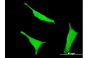 Immunofluorescence of monoclonal antibody to CD38 on HeLa cell. (CD38 Antikörper  (AA 201-300))