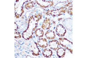Immunohistochemistry of paraffin-embedded mouse kidney using M Rabbit pAb (ABIN6130539, ABIN6143505, ABIN6143506 and ABIN6221614) at dilution of 1:100 (40x lens). (MAP4 Antikörper  (AA 942-1152))