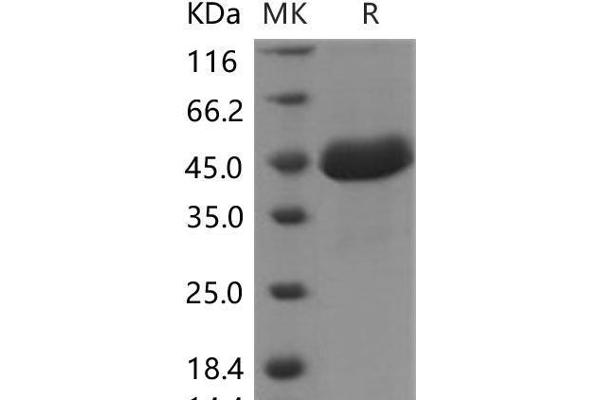 SPARCL1 Protein (His tag)