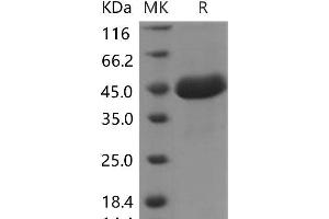 Western Blotting (WB) image for SPARC-Like 1 (Hevin) (SPARCL1) protein (His tag) (ABIN7320238)