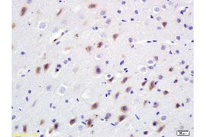 Formalin-fixed and paraffin embedded rat brain labeled with Anti-Bdkrb2/B2R Polyclonal Antibody, Unconjugated  at 1:200 followed by conjugation to the secondary antibody and DAB staining. (BDKRB2 Antikörper  (AA 51-150))