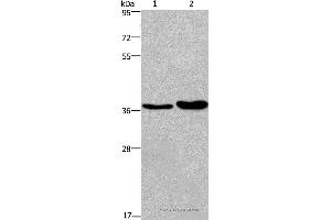 Western blot analysis of Human testis tissue and transitional cell carcinoma of bladder tissue, using FUT1 Polyclonal Antibody at dilution of 1:250 (FUT1 Antikörper)