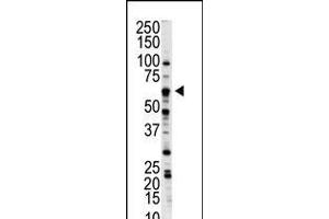 Western blot analysis of anti-NLK Pab in A375 cell lysate (Nemo-Like Kinase Antikörper  (C-Term))