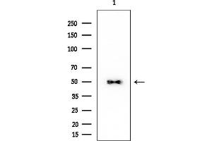 anti-Armadillo Repeat Containing 6 (ARMC6) (C-Term) antibody
