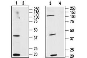 Western blot analysis of human HL-60 acute promyelocytic leukemia cell line lysate (lanes 1 and 2) and human MCF-7 breast adenocarcinoma cell line lysate (lanes 3 and 4):  - 1,3. (CNR2 Antikörper  (Extracellular, N-Term))