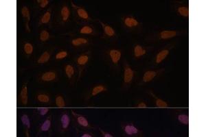 Immunofluorescence analysis of U-2 OS cells using FCF1 Polyclonal Antibody at dilution of 1:100. (FCF1 Antikörper)