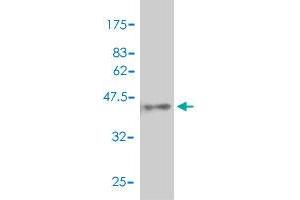 Western Blotting (WB) image for anti-Cyclin-Dependent Kinase Inhibitor 2B (p15, Inhibits CDK4) (CDKN2B) (AA 1-138) antibody (ABIN560313)
