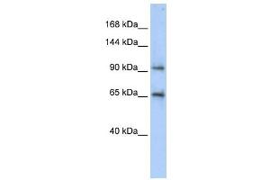 CCDC52 antibody used at 1 ug/ml to detect target protein. (SPICE1 Antikörper  (Middle Region))