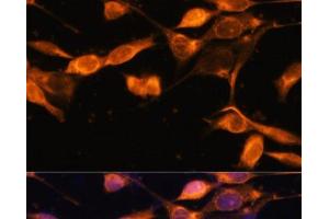 Immunofluorescence analysis of NIH-3T3 cells using RAB11A Polyclonal Antibody at dilution of 1:100. (RAB11A Antikörper)