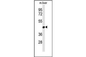 Western blot analysis of MMAA Antibody (N-term) Cat. (MMAA Antikörper  (N-Term))