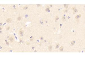 Detection of ASM in Human Cerebrum Tissue using Polyclonal Antibody to Acid Sphingomyelinase (ASM) (SMPD1 Antikörper  (AA 319-579))