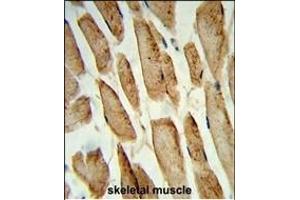 Immunohistochemistry (Paraffin-embedded Sections) (IHC (p)) image for anti-Polymerase (DNA Directed), gamma 2, Accessory Subunit (POLG2) (AA 348-376), (C-Term) antibody (ABIN1882118)
