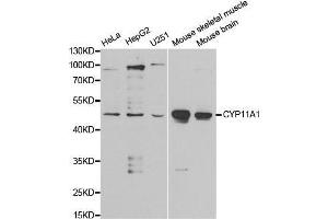 Western blot analysis of extracts of various cell lines, using CYP11A1 antibody. (CYP11A1 Antikörper  (AA 40-320))