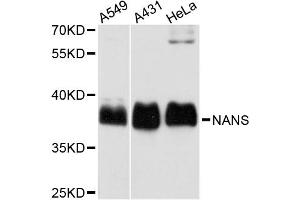 Western blot analysis of extracts of various cell lines, using NANS antibody (ABIN5972748) at 1:3000 dilution. (NANS Antikörper)