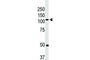 Western Blotting (WB) image for anti-Bone Morphogenetic Protein Receptor, Type II (serine/threonine Kinase) (BMPR2) (AA 28-59) antibody (ABIN3030192)