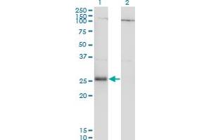 Western Blot analysis of RNF138 expression in transfected 293T cell line by RNF138 monoclonal antibody (M01A), clone 3G2. (RNF138 Antikörper  (AA 51-150))
