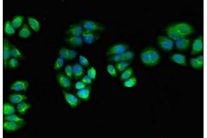 Immunofluorescent analysis of PC-3 cells using ABIN7166589 at dilution of 1:100 and Alexa Fluor 488-congugated AffiniPure Goat Anti-Rabbit IgG(H+L) (PPOX Antikörper  (AA 1-477))