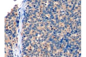Immunohistochemistry (IHC) image for anti-Inducible T-Cell Co-Stimulator Ligand (ICOSLG) (AA 23-249) antibody (ABIN7439975)