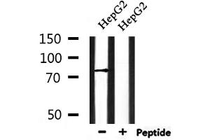 Western blot analysis of extracts from HepG2, using ENaC γ Antibody. (SCNN1G Antikörper  (C-Term))