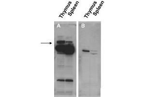 Image no. 1 for anti-Pogo Transposable Element with ZNF Domain (POGZ) (N-Term) antibody (ABIN401435) (POGZ Antikörper  (N-Term))