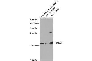 Western blot analysis of extracts of various cell lines, using UTS2 antibody (ABIN6128895, ABIN6150039, ABIN6150040 and ABIN6220965) at 1:1000 dilution. (Urotensin 2 Antikörper  (AA 35-124))
