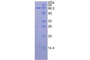 SDS-PAGE analysis of Human TERT Protein. (TERT Protein)