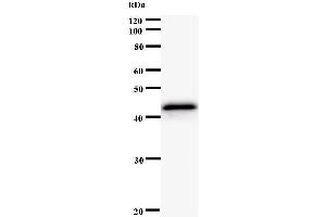 Western Blotting (WB) image for anti-Protein Kinase, CAMP-Dependent, Regulatory, Type I, alpha (Tissue Specific Extinguisher 1) (PRKAR1A) antibody (ABIN931105) (PRKAR1A Antikörper)