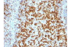 Formalin-fixed, paraffin-embedded human Tonsil stained with PD1 (CD279) Monoclonal Antibody (PDCD1/922). (PD-1 Antikörper)