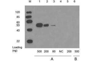 Lane 1,2,3 and 6: WISP2 full length recombinant protein with GST tag in 293 cell lysateLane 4: 10 µg 293 cell lysateLane 5: GST proteinPrimary antibody: A: 1 µg/mL Mouse Anti-WISP2 Monoclonal Antibody (ABIN398657) B: Negative controlSecondary antibody: Goat Anti-Mouse IgG (H&L) [HRP] Polyclonal Antibody (ABIN398387, 1: 10,000) The signal was developed with LumiSensorTM HRP Substrate Kit (ABIN769939) (WISP2 Antikörper)