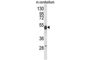 Western blot analysis of UBAP1 Antibody (N-term) in mouse cerebellum tissue lysates (35ug/lane).