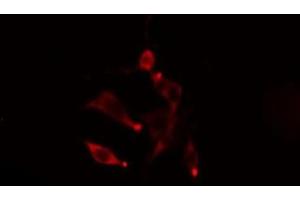 ABIN6275470 staining  LOVO cells by IF/ICC. (Rab5c Antikörper  (Internal Region))