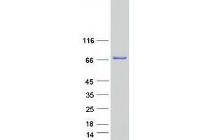Western Blotting (WB) image for Lanosterol Synthase (2,3-Oxidosqualene-Lanosterol Cyclase) (LSS) (Transcript Variant 2) protein (Myc-DYKDDDDK Tag) (ABIN2724503)