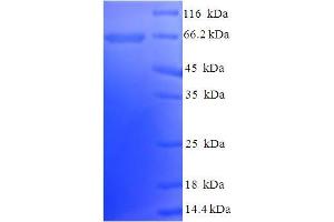 SDS-PAGE (SDS) image for Natriuretic Peptide Receptor B/guanylate Cyclase B (Atrionatriuretic Peptide Receptor B) (NPR2) (AA 23-458), (Extracellular) protein (His-SUMO Tag) (ABIN4975489) (NPR2 Protein (AA 23-458, Extracellular) (His-SUMO Tag))