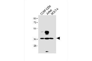 All lanes : Anti-TAL1 Antibody (T90) at 1:1000 dilution Lane 1: CCRF-CEM whole cell lysate Lane 2: Jurkat whole cell lysate Lane 3: MOLT-4 whole cell lysate Lysates/proteins at 20 μg per lane.