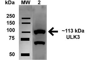 Western blot analysis of Human HeLa cell lysates showing detection of 112. (ULK2 Antikörper  (AA 558-569) (Atto 488))