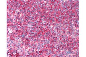 Anti-CD82 antibody IHC of human spleen. (CD82 Antikörper  (C-Term))