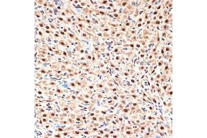 Immunohistochemistry of paraffin-embedded rat ovary using CDC16 Rabbit mAb (ABIN1678585, ABIN3017837, ABIN3017838 and ABIN7101525) at dilution of 1:100 (40x lens). (CDC16 Antikörper)