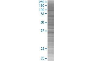 EIF2B2 transfected lysate. (EIF2B2 293T Cell Transient Overexpression Lysate(Denatured))