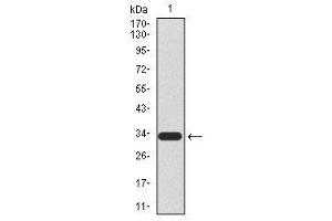 Image no. 2 for anti-HIR Histone Cell Cycle Regulation Defective Homolog A (HIRA) antibody (ABIN1490946) (HIRA Antikörper)