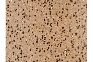 ABIN7094647 and ABIN7098698 at 1/100 staining Rat brain tissue by IHC-P.
