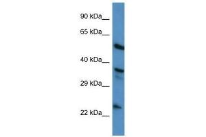 Western Blot showing ANXA1 antibody used at a concentration of 1. (Annexin a1 Antikörper  (N-Term))