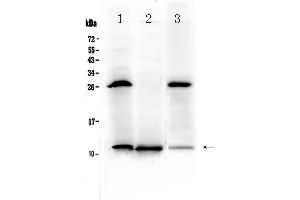 Western blot analysis of TFF3 using anti-TFF3 antibody .