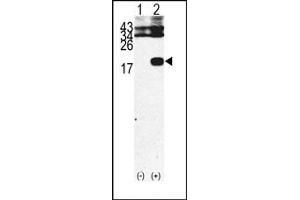 Image no. 1 for anti-beta-2-Microglobulin (B2M) (C-Term) antibody (ABIN357932) (beta-2 Microglobulin Antikörper  (C-Term))