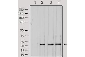 Western Blotting (WB) image for anti-Suppressor of Cytokine Signaling 2 (SOCS2) antibody (ABIN6265216)