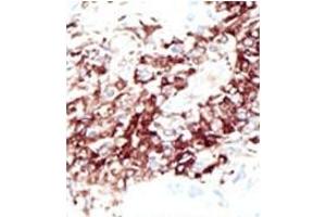 Image no. 1 for anti-Histone Deacetylase 11 (HDAC11) (N-Term) antibody (ABIN356659) (HDAC11 Antikörper  (N-Term))
