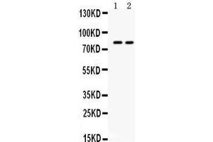 Western blot analysis of ZP2 expression in HELA whole cell lysates (lane 1) and HEPG2 whole cell lysates (lane 2). (ZP2 Antikörper  (N-Term))