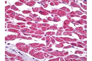 Anti-PTGES2 antibody IHC of human heart. (PTGES2 Antikörper)