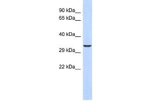 Western Blotting (WB) image for anti-Ventral Anterior Homeobox 1 (VAX1) antibody (ABIN2458264) (VAX1 Antikörper)